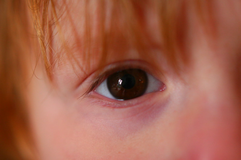image of a child's eye