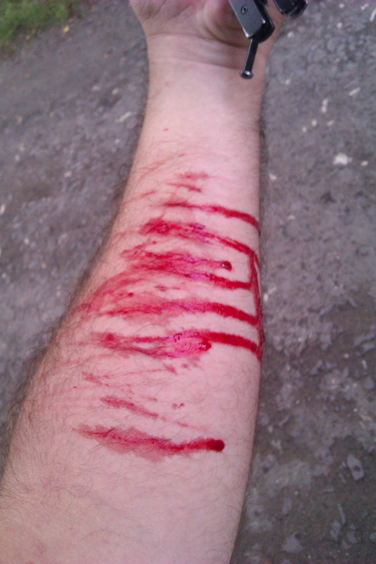 an image of self harm cuts on a forearm